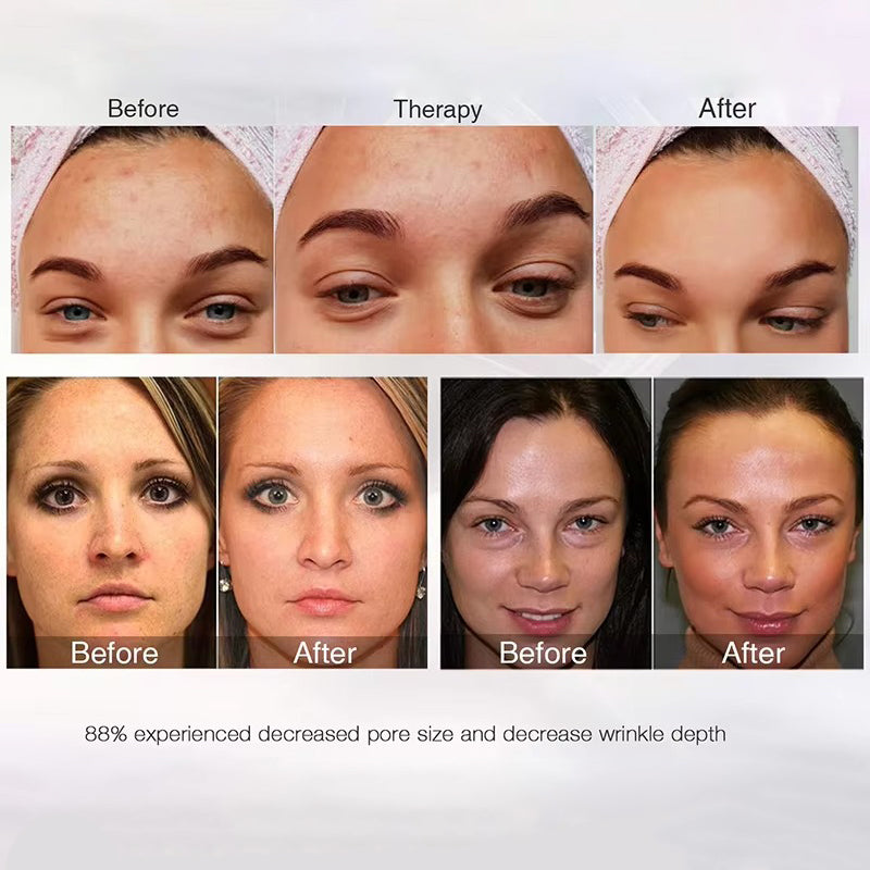 Premium LED Facial and Neck Rejuvenation Machine – Skin Rejuvenation Massager for Anti-Aging, Wrinkle Reduction, and Skin Tightening with Advanced Light Therapy - StrengthXPhysiotherapy