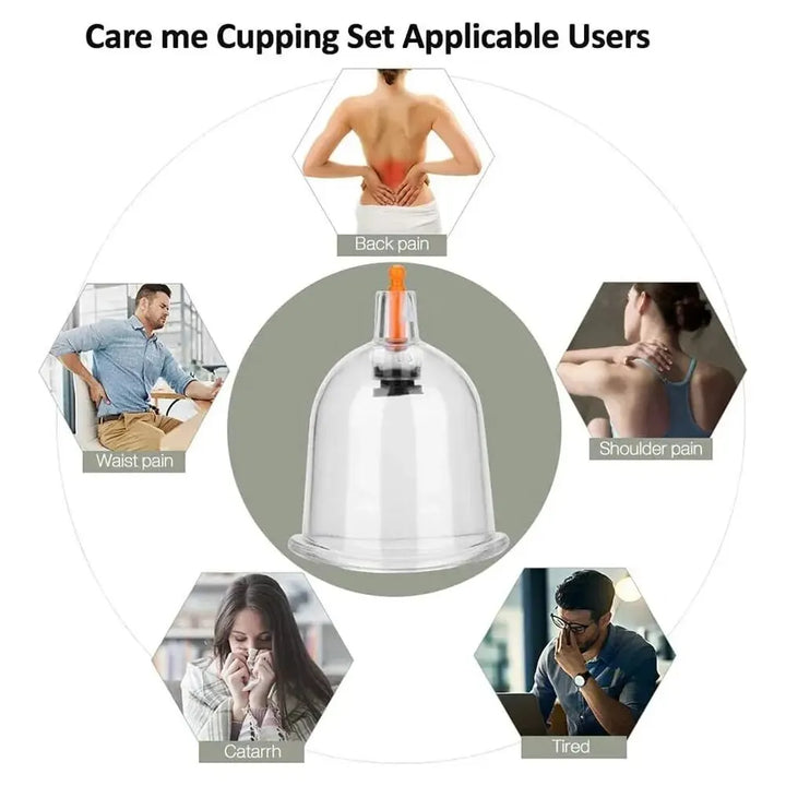 Premium Cupping Therapy Set – Professional Vacuum Suction Cups for Chinese Medicine Physiotherapy, Massage, and Muscle Relaxation, Durable Plastic Jars for Home and Professional Use - StrengthXPhysiotherapy