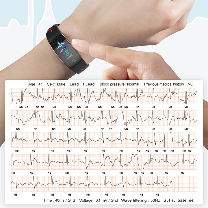 Premium Smart Wristband – Body Temperature Monitoring, ECG+PPG, Heart Rate, Blood Pressure, Color OLED Display, IP67  